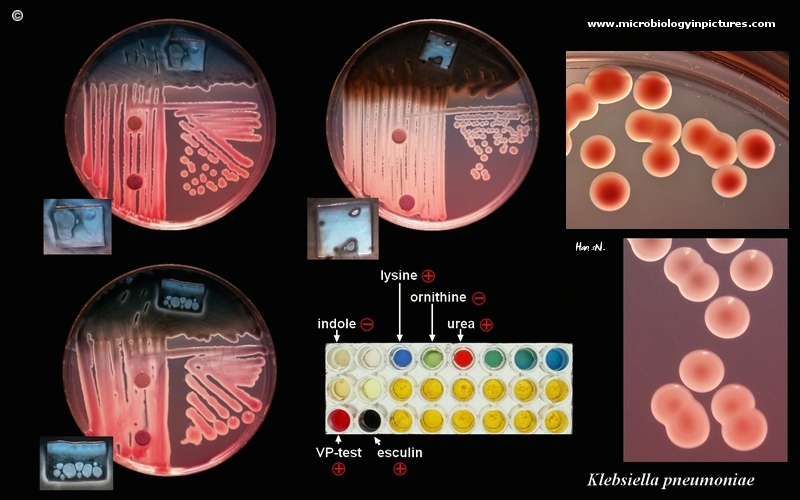Klebsiella pneumoniae picture